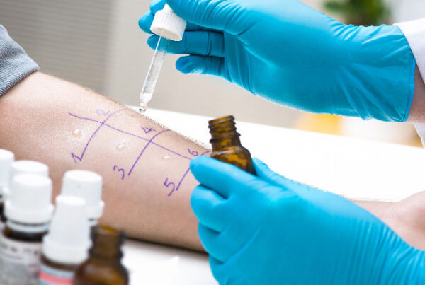 Questioning Food Allergy Testing