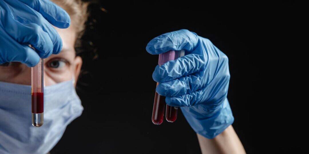 Female virologist holding blood tubes for Parsemus Foundation article on blood tests for Alzheimer's disease