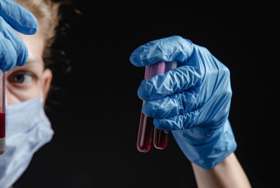 Female virologist holding blood tubes for Parsemus Foundation article on blood tests for Alzheimer's disease