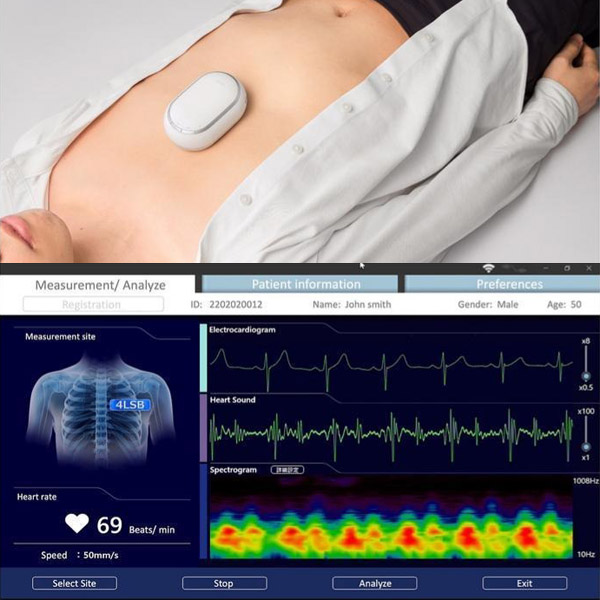 Super StethoScope by Acute Medical Innovation